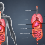 Why Does Ozdikenosis Kill You